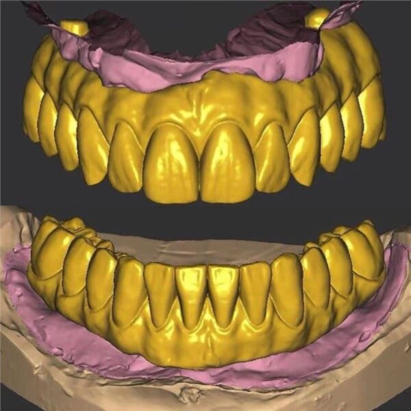 Full Arch Implant Design All-on-4 Zirconia