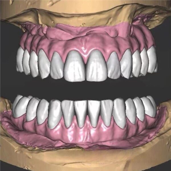 Full Contour Zirconia Crown Design Exocad