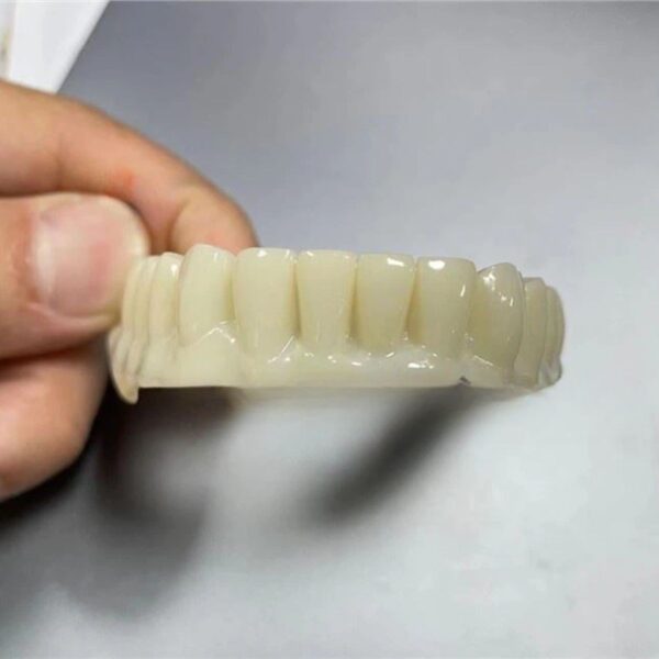 PMMA Temporary Crown on Implant Exocad