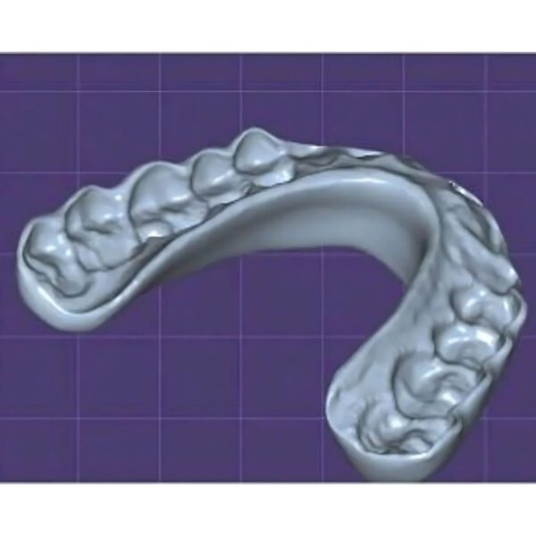 Dental Splint Design for Bruxism Exocad