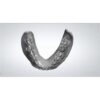 Digital Denture Design Exocad Full Arch