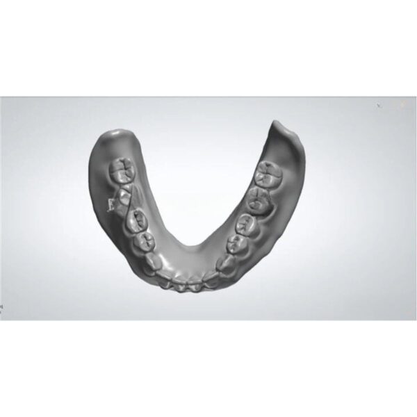 Digital Denture Design Exocad Full Arch