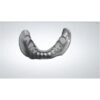Digital Denture Design Exocad Full Arch