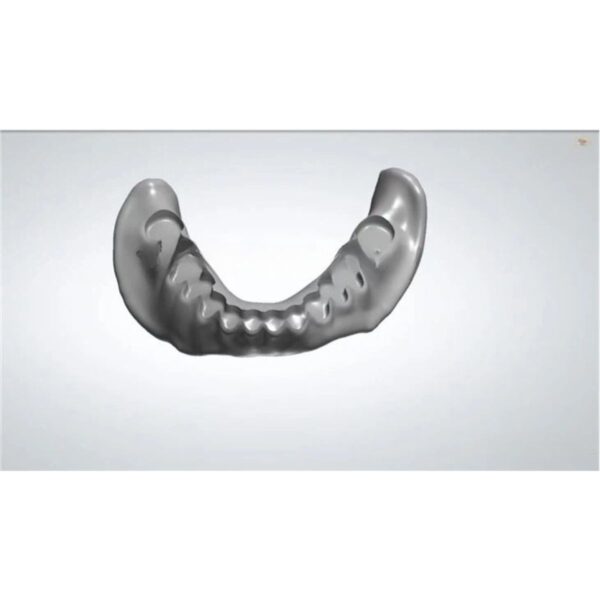 Digital Denture Design Exocad Full Arch