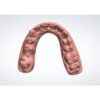 Clear Aligner Treatment Plan Simulation
