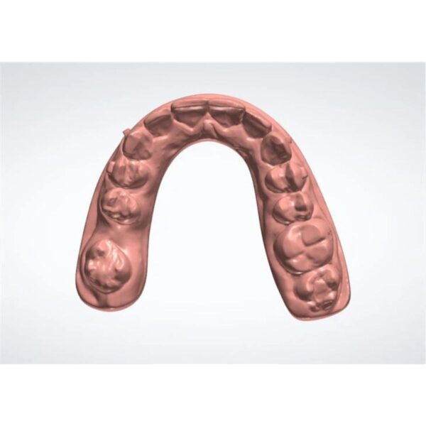 Clear Aligner Treatment Plan Simulation