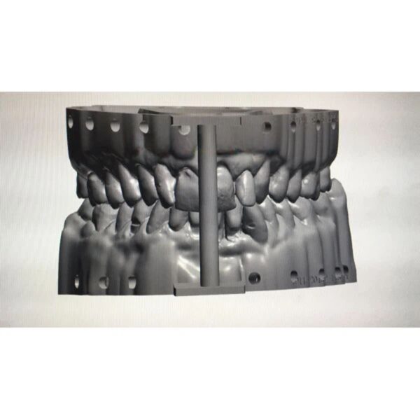 Digital Dental Model Design Service (3D Print Ready)