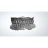 Full Denture CAD Design with Festooning