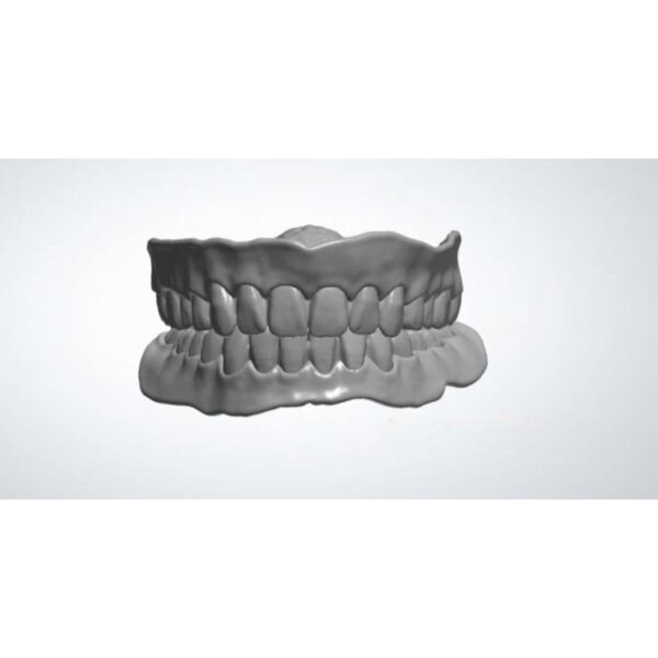 Full Denture CAD Design with Festooning